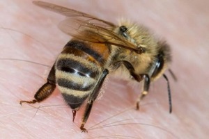 Що робити при укусі оси, бджоли чи джмеля