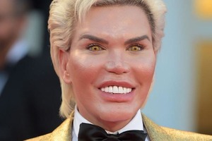 «Я всегда хотел стать Барби». Живой Кен после 76 операций таки превратился в женщину