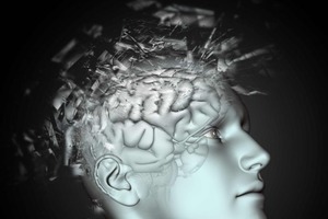 Названы питательные вещества, которые предотвращают инсульты