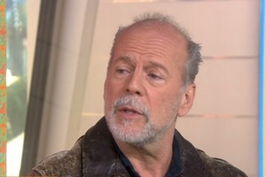 Брюсу Віллісу зробили операцію