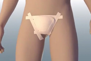 Как родной: В США состоялась первая успешная трансплантация пениса