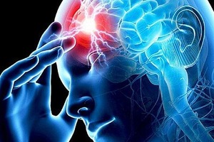 Капельницы бесполезны: Супрун развенчала мифы о лечении инсульта