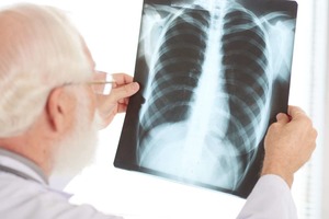 Назван новый признак начинающейся пневмонии при COVID-19: как определить