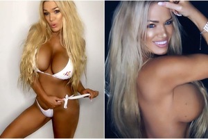 47-летняя «секси бабушка» призналась, что импланты убивают ее