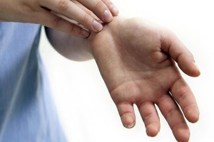 К чему на самом деле чешутся ладошки и стопы