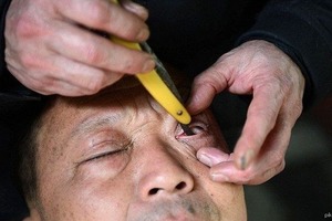 Бритье глаза в Китае попало на видео