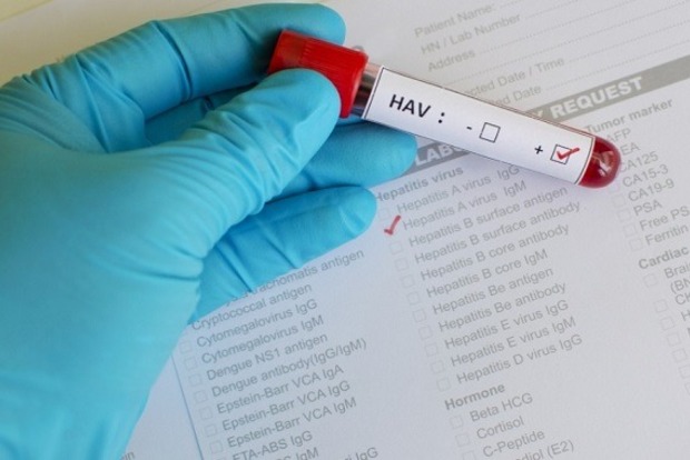 Минздрав: В Украине нет эпидемии гепатита А