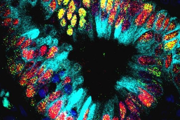 Ти не повіриш: Вченими виявлено мікроскопічний шлунок усередині пухлини легенів