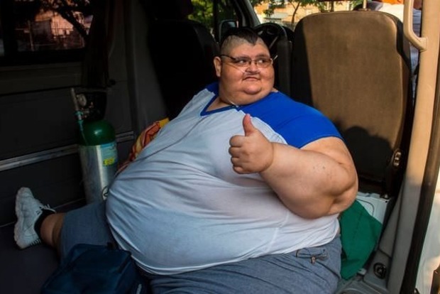 Найтовстіша людина в світі схудла заради операції