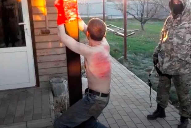 Кастрирование и снятие скальпа: на Донбассе зафиксировано 600 случаев пыток