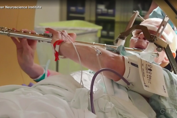 Американка сыграла на флейте во время операции на мозге. Поразительное видео