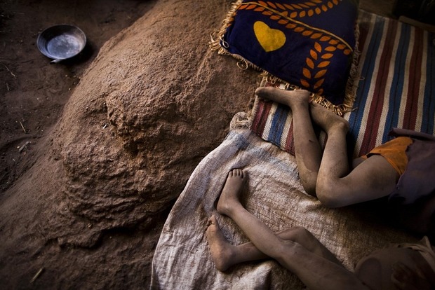 В Африке и на Ближнем Востоке 1,4 млн детей угрожает голодная смерть - ООН