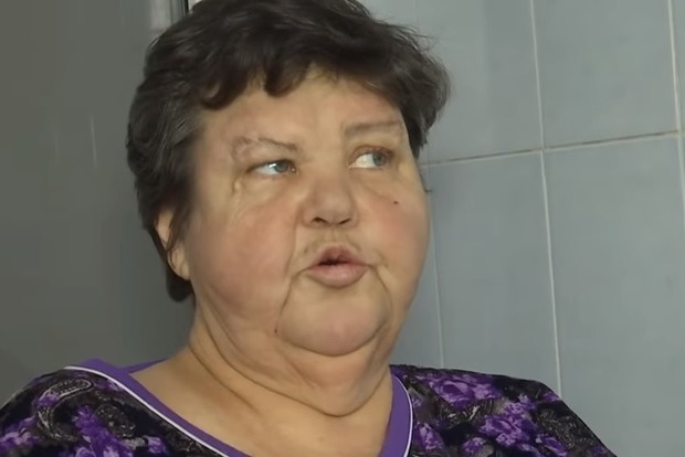 На Николаевщине из-за безразличия врачей женщине отрезали ногу