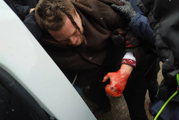 В Одессе произошли беспорядки на акции в поддержку пленных моряков