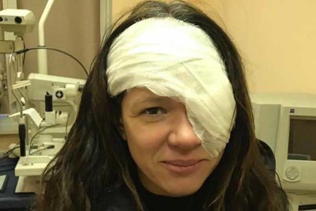 Руслана показала наслідки операції на обличчі