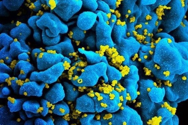 Вчені знайшли ліки, послаблюючі ВІЛ