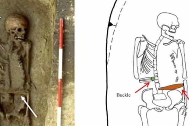 Археологи знайшли в Італії скелет чоловіка-кіборга з рукою-ножем
