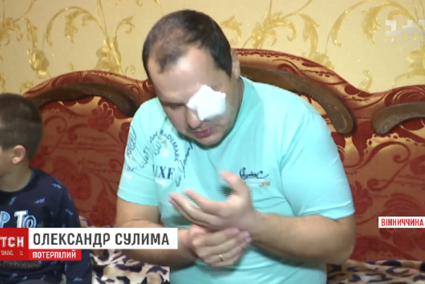 Женщина ногой выбила глаз полицейскому в Винницкой области