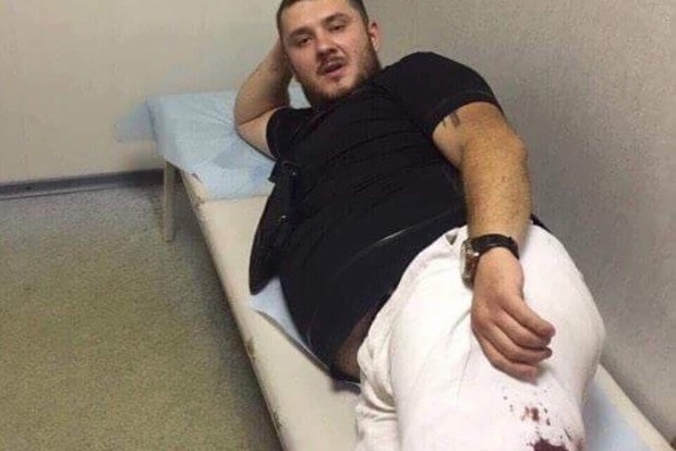 Стрелявшие в АТОвцев преступники сами попали в больницу в Днипре