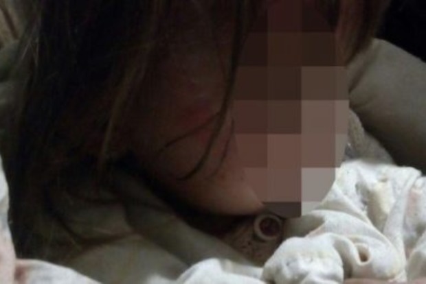Пьяная мать на Закарпатье едва не задушила ребенка: дети вызвали полицию