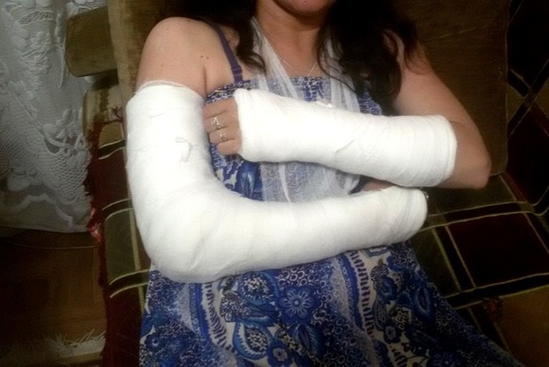 В Житомире девушка выходя из маршрутки, сломала обе руки