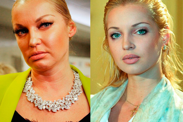 Пропила красоту: СМИ сравнили Волочкову в молодости и в зрелом возрасте