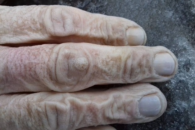 ﻿У Маріуполі у водостоку знайшли кисті рук людини