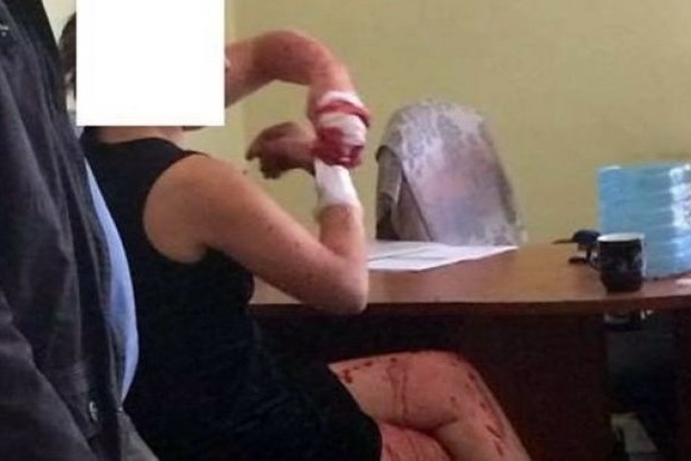 Во Львове из психбольницы сбежала россиянка, которая облила кислотой сотрудницу ЗАГСа