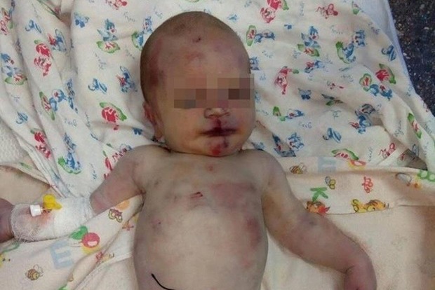 В Первомайске от сепсиса умер новорожденный, подброшенный под больницу