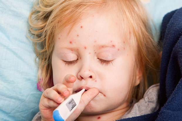 Эпидемия кори в Украине: детей без прививок не будут пускать в школы и садики