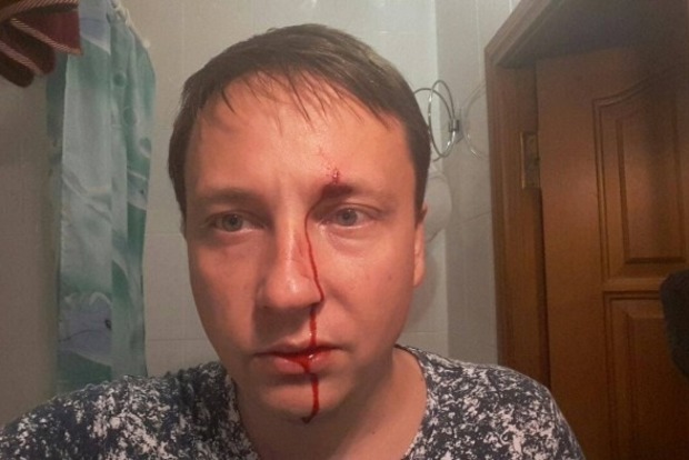 Депутату міськради Одеської області від партії «Відродження» невідомий підбив око