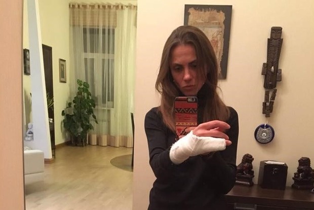 В полиции Киева расследуют задержание женщины с переломом руки