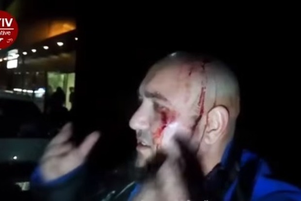 Біля метро в Києві сталася стрілянина, є постраждалі