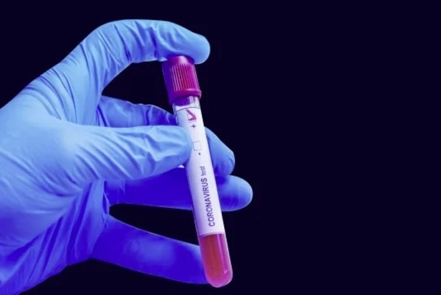 В Украине испытывают первый препарат-генерик  от коронавируса