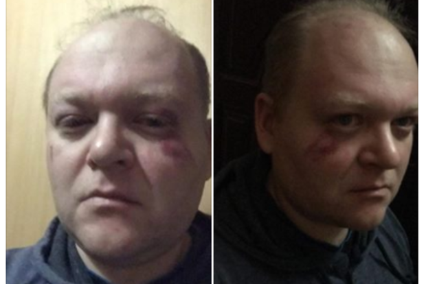 С криками зиг хайль в Киеве жестоко избили актеров Травести шоу
