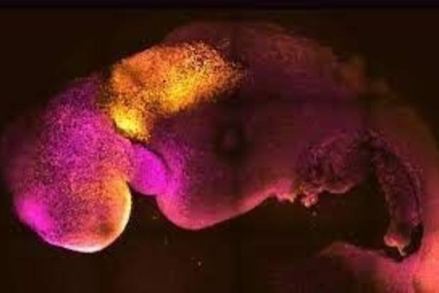 Вчені синтезували першу модель людського ембріона, повідомляє CNN.