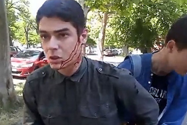 Били в голову и целились в почку: в Одессе изрезали ножом лидера местного Автомайдана