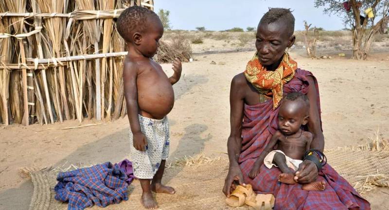 Чому у африканських дітей великі животи, якщо вони живуть впроголодь