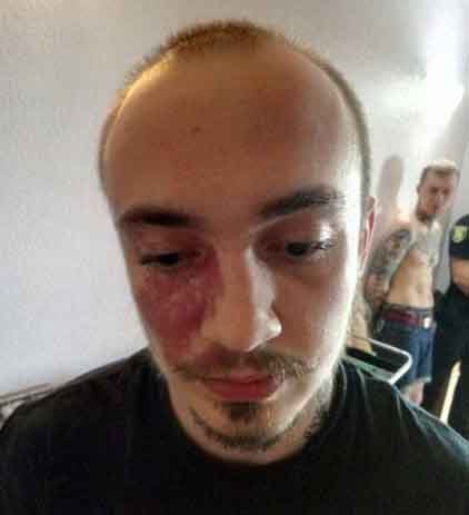 Нападение на бойца АТО, Дмитрий Вербич нож, гражданин России, задержание в Харькове